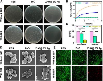 Multifunctional phototheranostic agent ZnO@Ag for anti-infection through photothermal/photodynamic therapy